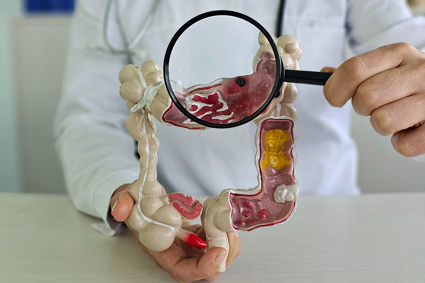 Pulmo Sleep Centar Eliksir | Gastroenterologija i Hepatologija