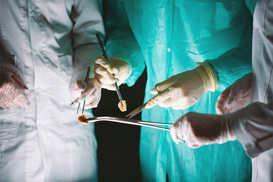 Pulmo Sleep Centar Eliksir | Transplantacija organa – sve što treba da znate o ovoj proceduri