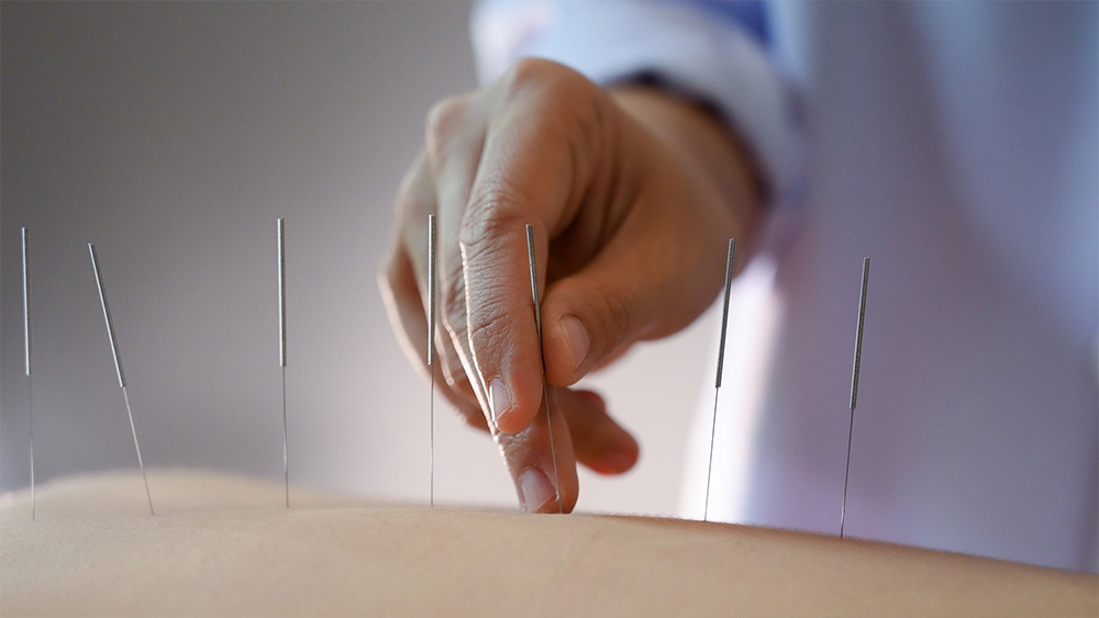 Pulmo Sleep Centar Eliksir | Akupunkturni tretman