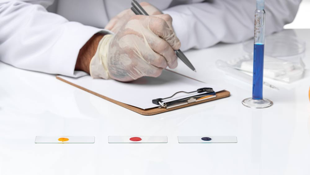 Pulmo Sleep Centar Eliksir | Antifosfolipidni sindrom – dijagnostika i procena trombotičkog rizika