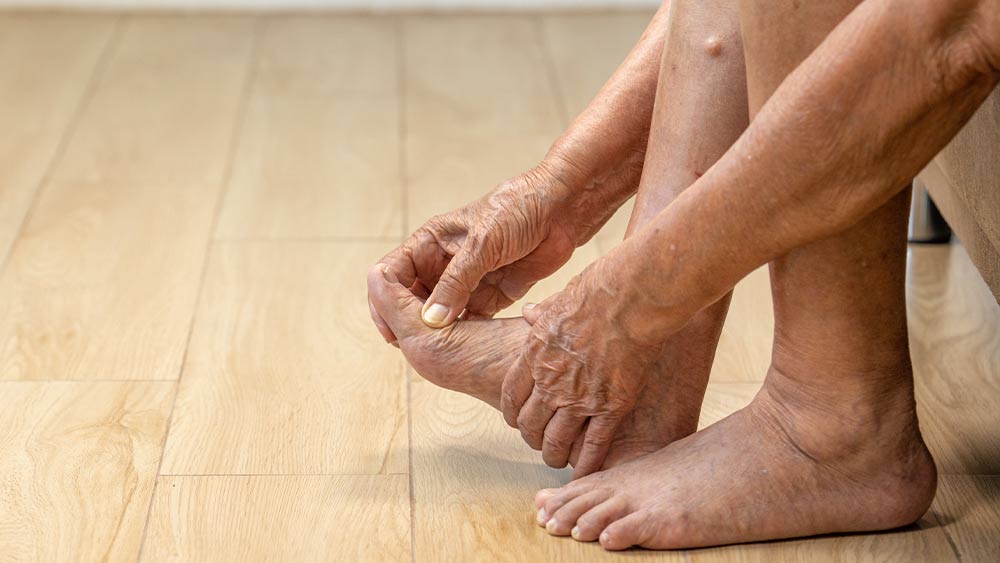 Pulmo Sleep Centar Eliksir | Giht (urični artritis) – dijagnostika i regulacija mokraćne kiseline