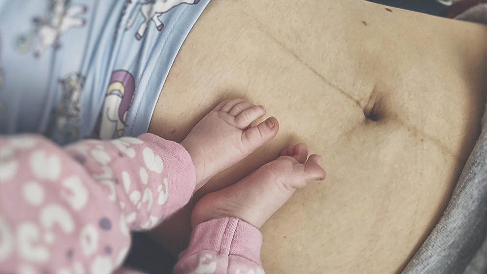 Pulmo Sleep Centar Eliksir | Nega nakon carskog reza