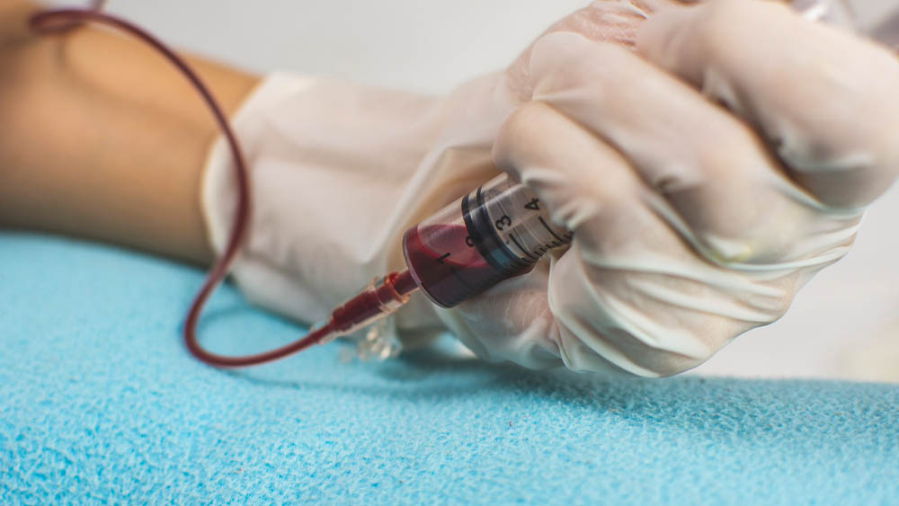 Pulmo Sleep Centar Eliksir | Punkcija arterije radi gasnih analiza